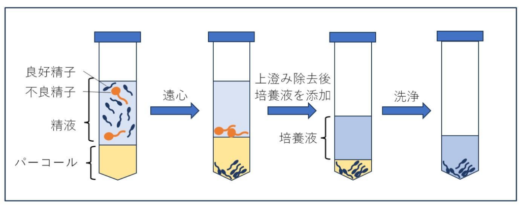 密度勾配遠心法(パーコール法)