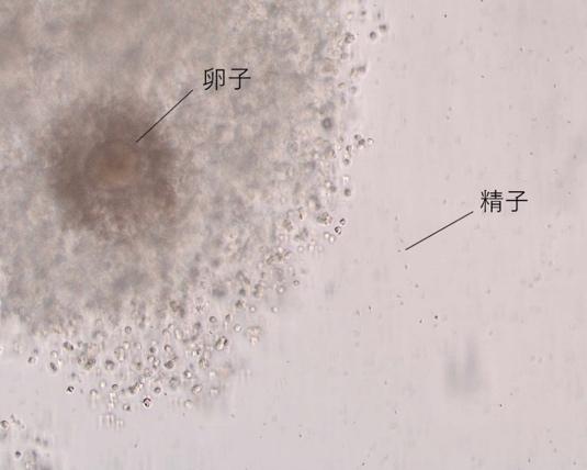 媒精法 卵子 精子