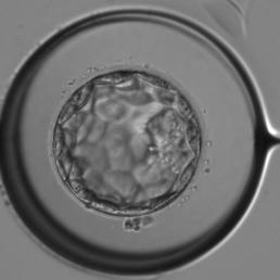 胚の発育の段階