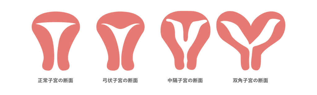 子宮内の形態