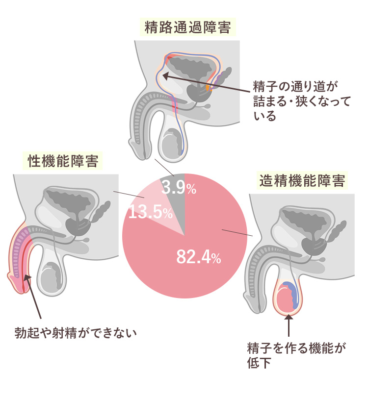 男性不妊の要因 グラフ