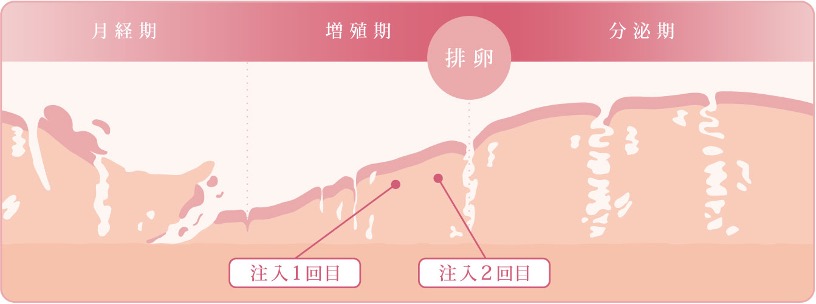 胚移植周期と投入スケジュール